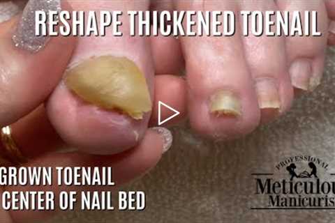 Pedicure Tutorial: Stop Hiding Your Nails Optical Illusion for Thick Toenails