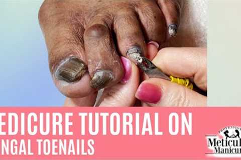 👣How to Pedicure on Thick Dark Toenails with Nail Fungus👣