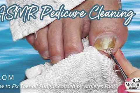 👣ASMR Pedicure Cleaning💆‍♀️How to Fix Toenail Fungus caused by Athletes Foot👣