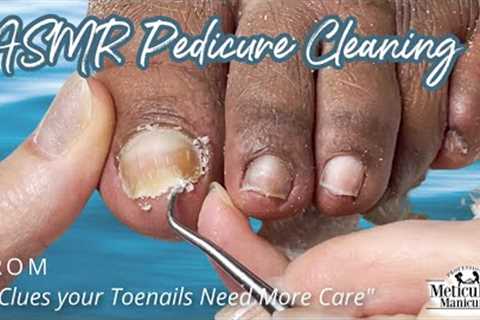 👣ASMR Pedicure Cleaning💆‍♀️3 Clues your Toenails and Feet Need More Care👣