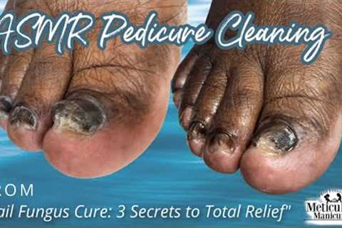 👣ASMR Pedicure Cleaning💆‍♀️Nail Fungus Cure: 3 Secrets to Total Relief👣