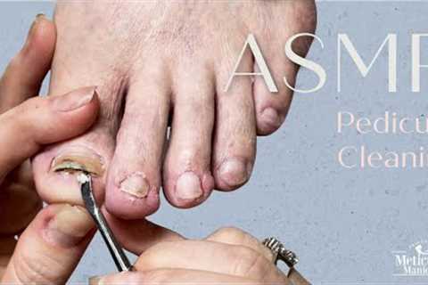 👣ASMR Pedicure Cleaning💆‍♀️Pedicure for Men - Repair Damaged Toenails👣