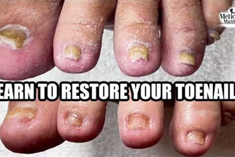 👣Learn to Restore Your Toenails👣