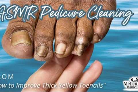 👣ASMR Pedicure Cleaning💆‍♀️How to Improve Thick Yellow Toenails👣