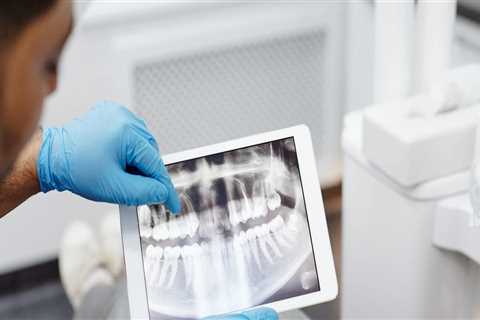 Cosmetic Dentistry Trends: Advancements and Innovations