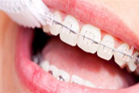 What are the Golden Rules of Dental Health