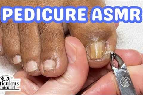 👣ASMR Pedicure Cleaning💆‍♀️How to Fix Big Toenails & Pinky Nails Pedicure Tutorial👣