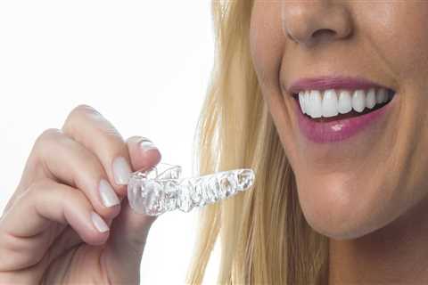 How long do you have to Wear SureSmile Aligners