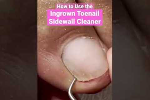 How to use the Ingrown Toenail Sidewall Cleaner #ingrowntoenail #pedicure #meticulousmanicurist